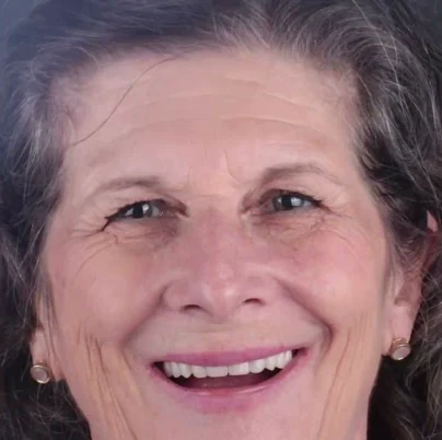 Maria Luisa, patient at IDF Oral Clinic