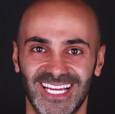Paul, patient at IDF Oral Clinic