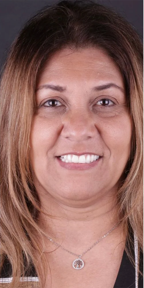 Before and after with a dental prosthesis