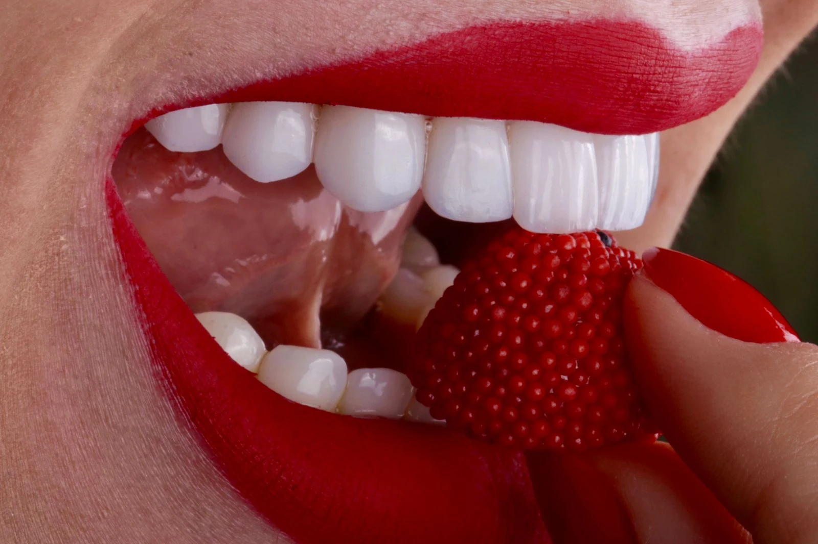 Result of Porcelain Veneers at IDF Oral Clinic